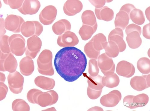 原始红细胞   11