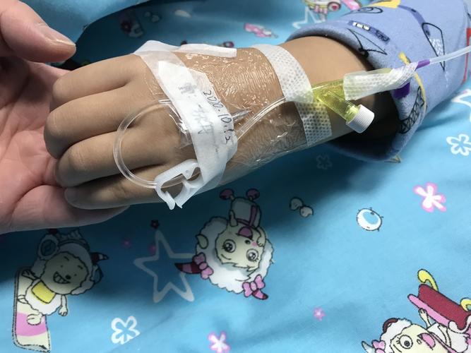 留置针在儿科广泛应用