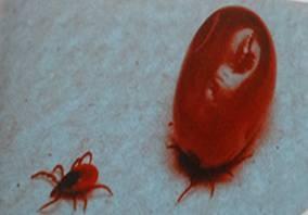 一例蜱虫叮咬的病例分析