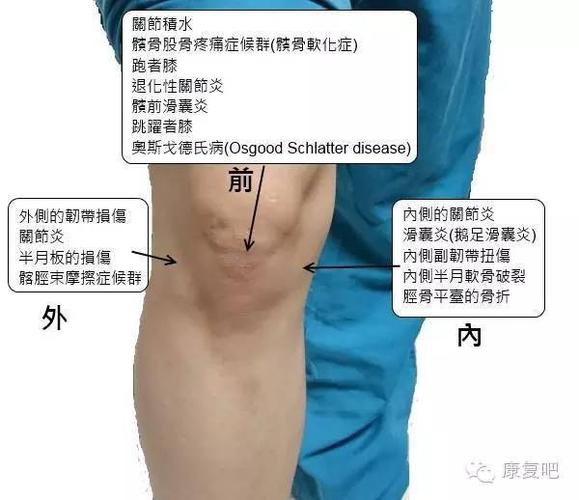 膝盖某个位置的疼痛, 水肿, 发炎反应, 或是不正常的声响; 2.