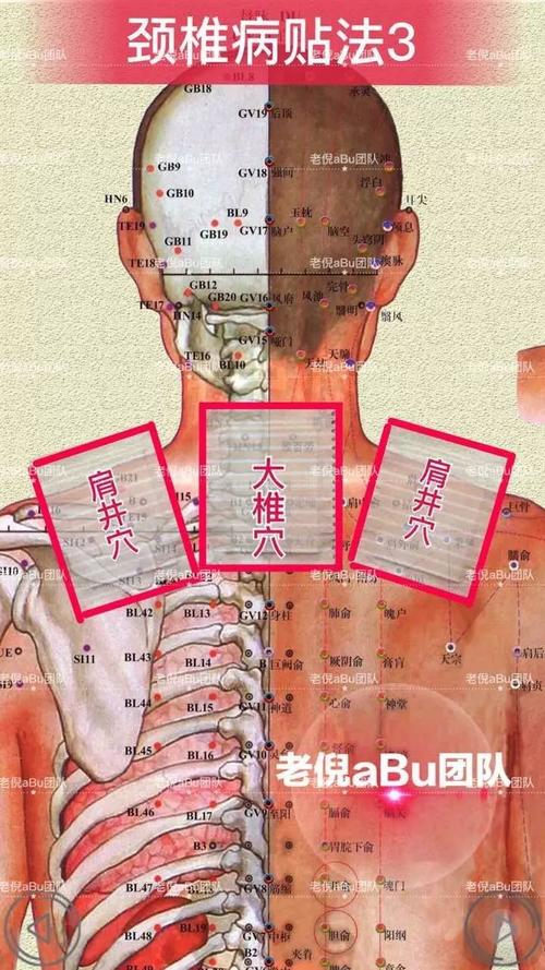 老倪膏药颈椎病穴位贴法_老倪膏药祖三贴全国运营中心