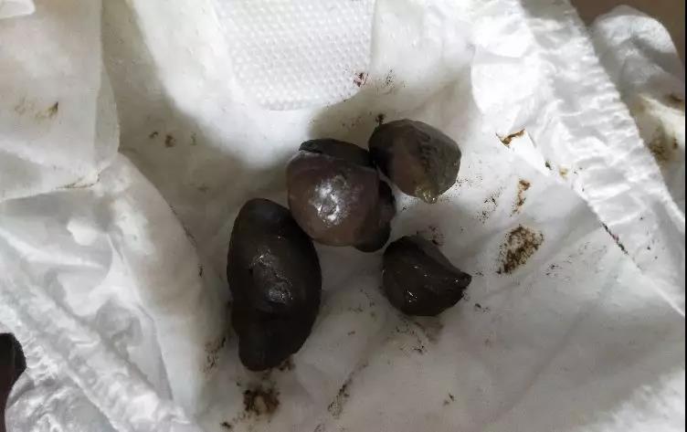 脾虚导致的大便干燥, 可采用健脾补气的药材如太子参,党参,黄芪,红枣