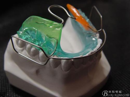 1)activator(肌激动器):1908 年由andresen设计,又称为andresen矫正