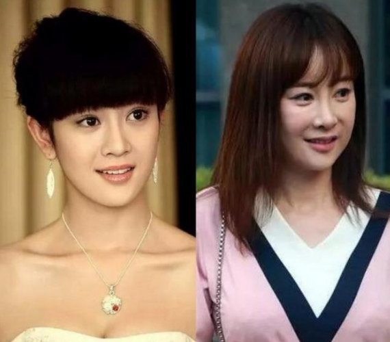 盘点娱乐圈整容失败的女明星,有的整的像僵尸,最后一个可惜了