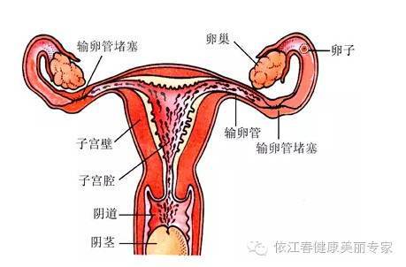 附件炎等,如果不及时治疗,炎症扩散到输卵管时,就会导致输卵管堵塞
