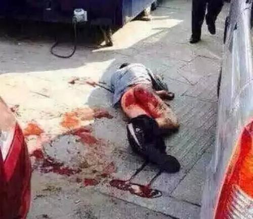 小三衣服被脱,男子蛋蛋被割,太惨了