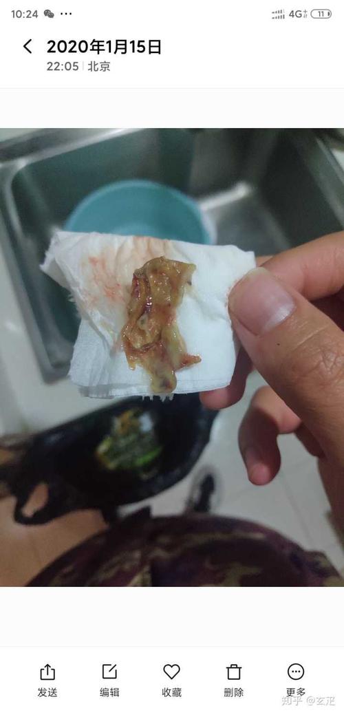 人的鼻屎能大到什么程度?