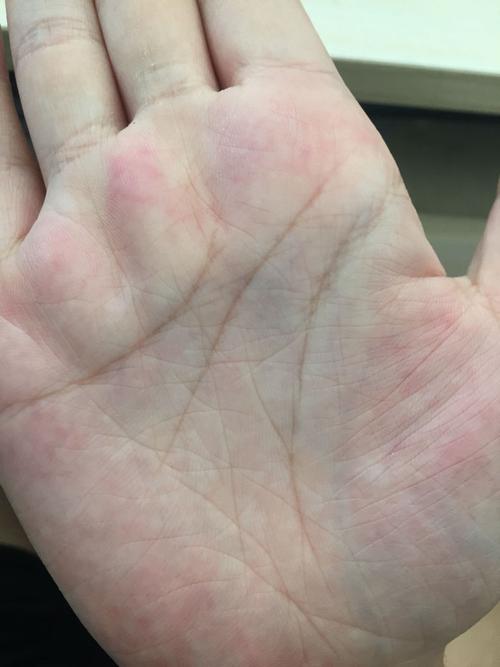 希望有一个真正懂的人帮我解一下我的生命线,右手的生命线是我10几岁