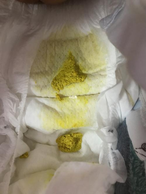 25天宝宝吃a2奶粉的大便,有图慎入74_a2奶粉_奶粉_母婴_婴童食品