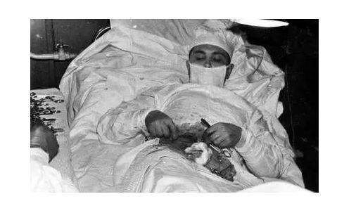 医者不自医,这位医生把自己开膛破肚,局麻状态给自己做手术.