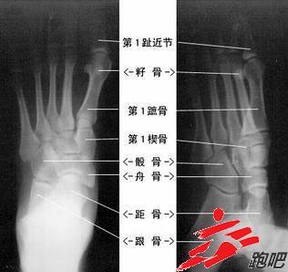足部骨骼图解大全