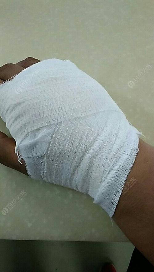 受伤不下钓箱,激情夜钓美丽野生水库.