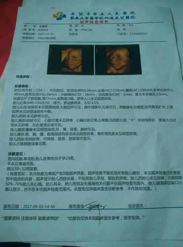 树下 同龄 2017年7月同龄圈 各位宝妈们四维报告说胎儿1度唇裂因裂口