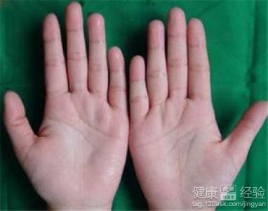 从手掌的颜色知道身体健康的状况