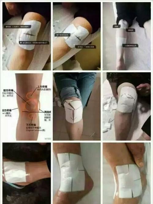 老薛膏药贴法图