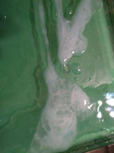 精液中的精子跟果冻很像吗?正常吗?