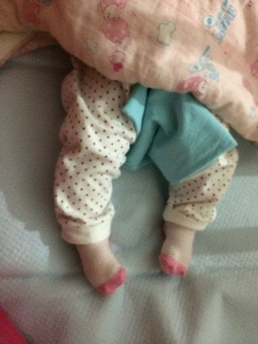 问:宝宝快三个月了,脚为什么是这个样子?谢谢!