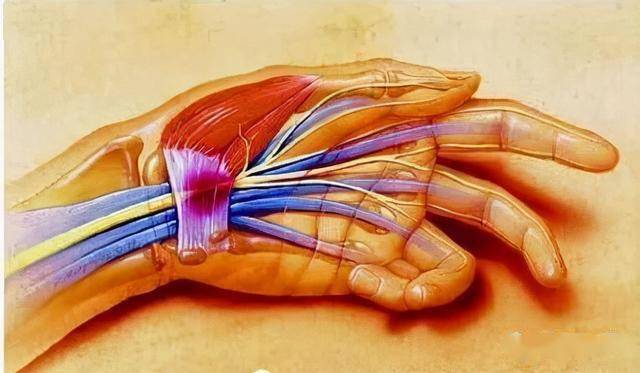 肌腱断裂是啥病?都有哪些危害呢?