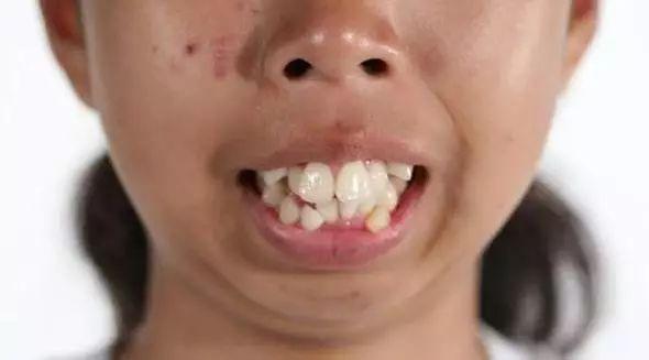 23岁泰国龅牙妹整容后变万人迷,坦言:以前都找不到工作