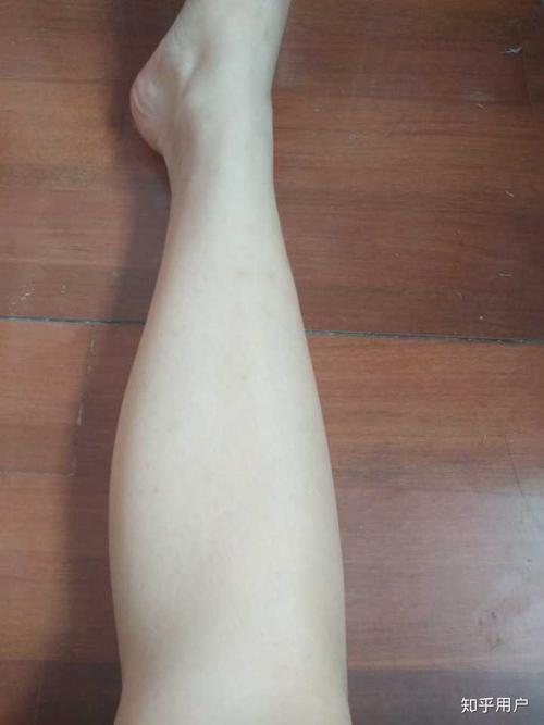 小腿能粗到什么地步?