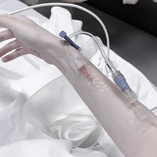 女生输液真实手背照片2020超清 女生输液图片真实照片