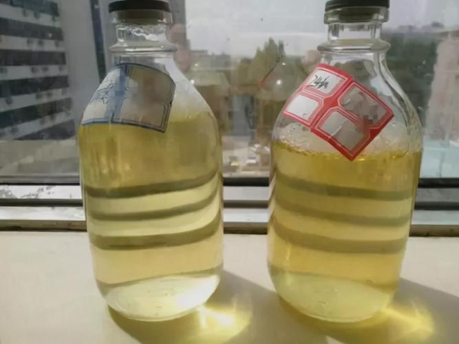 另外, 还有不少人认为泡沫尿就是"蛋白尿"?