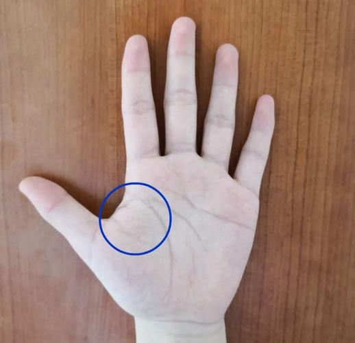 手掌青筋不退,竟然是血管在报警……|大鱼际|涌泉穴