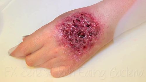 【特效化妆】生化腐蚀皮肤伤效妆
