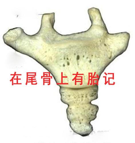 2,在尾骨上有胎记