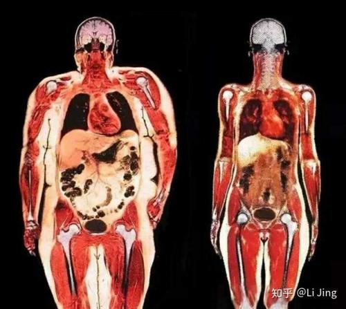 那里面有个大肚子剖面图,肚子越大里面黄色油脂越多.