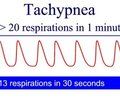 图片: tachypnea
