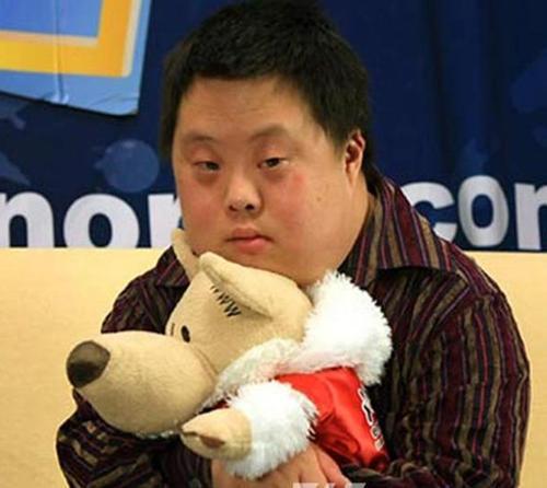 唐氏综合症会遗传后代吗?看完您就明白了!