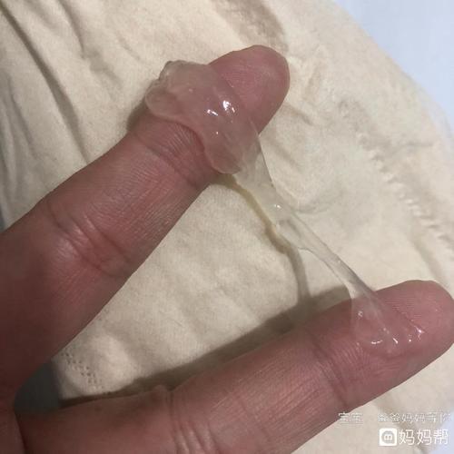这样的白带是什么情况,跟果冻一样