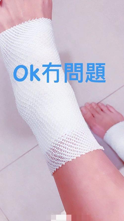 张柏芝扭伤脚要用拐杖脚踝明显肿起伤势较严重不忘调侃自己