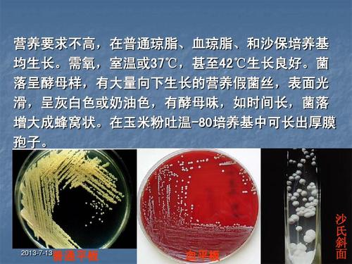 白假丝酵母菌ppt