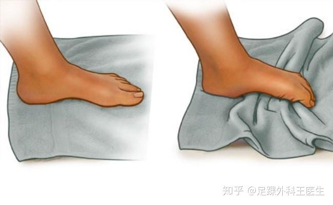 莫顿神经瘤究竟是什么鬼