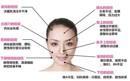 对于爱美的人来说脸上长痘痘的确是一个非常让人头疼的问题,皮肤也是