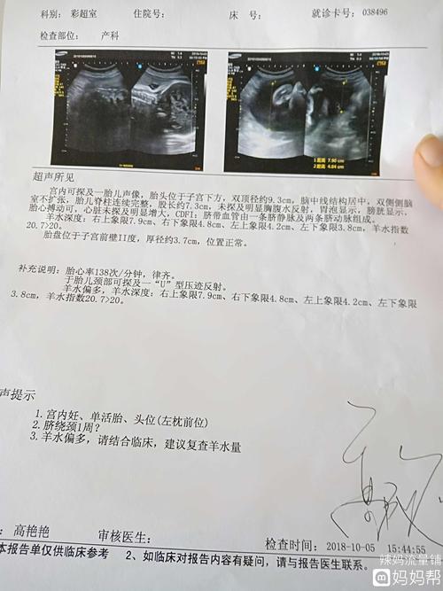怀孕35周,医生说像38周