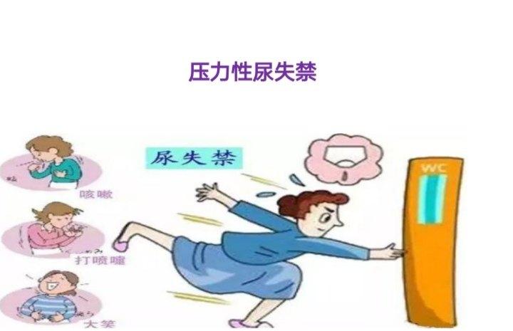 了解盆底疾病,关注女性健康_压力性尿失禁_症状_治疗方法 - 好大夫