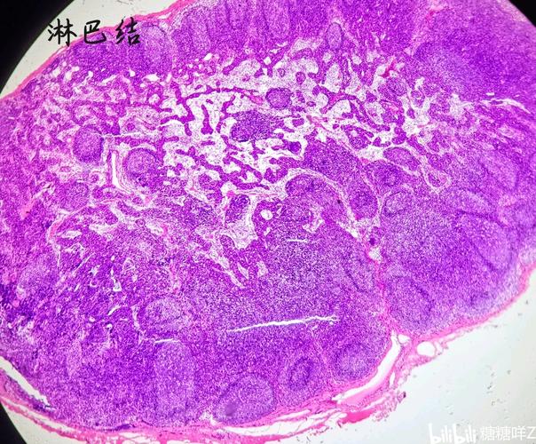 关于组胚那些分不清的标本对比图