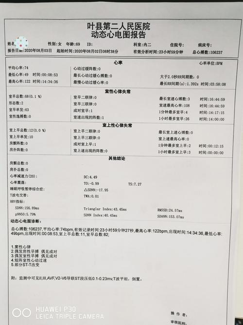 动态心电图检查