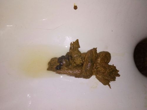 这几天大便里有黑色的东西,我胃不太好,今天擦的时候隐约有血,很少