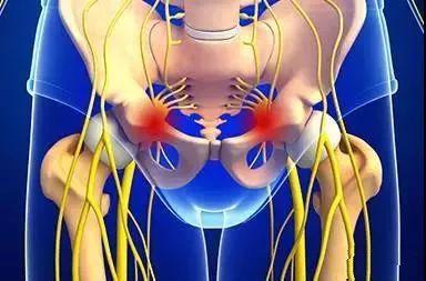 盆底电刺激治疗的原理必须收藏