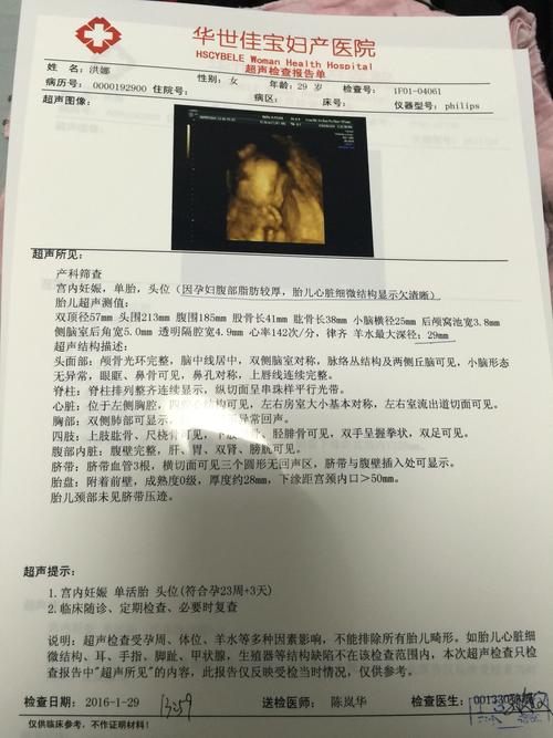 今天拍四维医生说是女宝