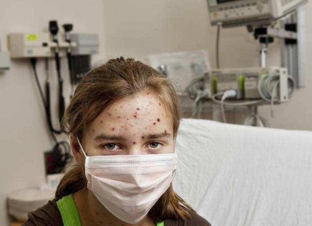 女子皮损瘙痒以为湿疹,一查竟是梅毒!梅毒哪些症状易被误诊?