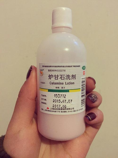 你可以像我这样做 第二个方法就是涂炉甘石,药店里面都可以买到的
