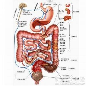 直肠炎和结肠炎一样吗