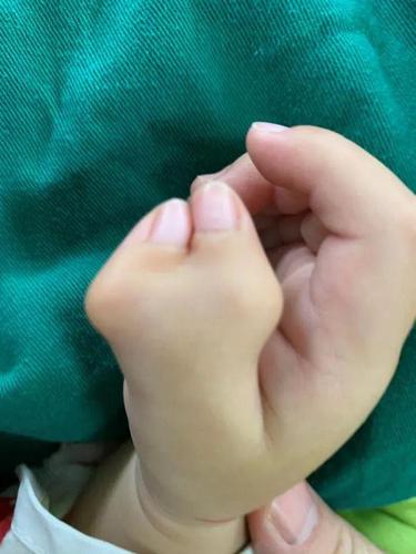 宝宝刚出生长"六指",婆婆一句话,妈妈懵了