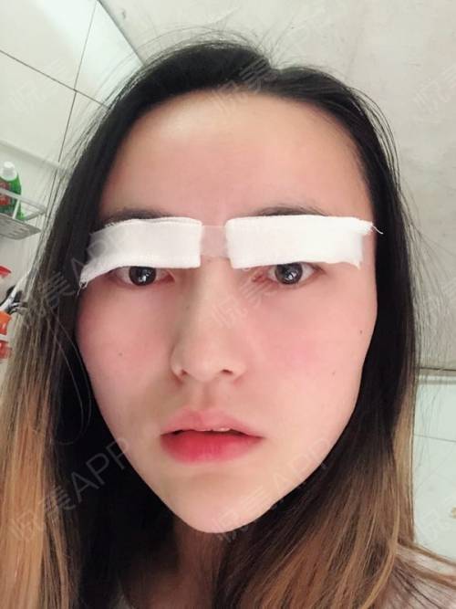 包着纱布但感觉一定会很好看很好看!哈哈哈.