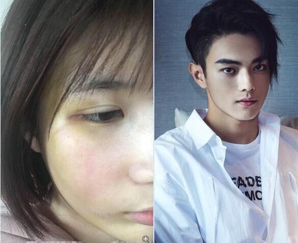 > 许凯个人资料简介-最新动态-face明星库